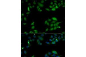 Immunofluorescence analysis of MCF7 cells using HIP1 Polyclonal Antibody (HIP1 antibody)