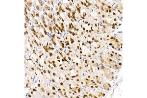 Immunohistochemistry (IHC) image for anti-GATA Binding Protein 4 (GATA4) antibody (ABIN7267359)