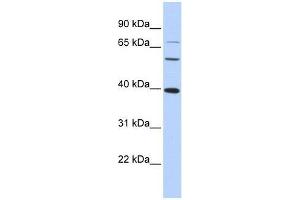 MAF antibody used at 1. (MAF antibody  (N-Term))