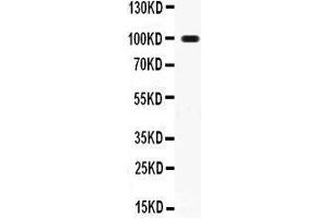 Anti- RANK Picoband antibody, Western blotting All lanes: Anti RANK  at 0. (TNFRSF11A antibody  (AA 35-214))