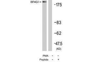 Western blot analysis of extract from 293 cells, using EIF4G1 polyclonal antibody . (EIF4G1 antibody  (Ser1232))