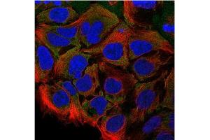 Immunofluorescence: This antibody stained CACO-2 cells. (CCL28 antibody)