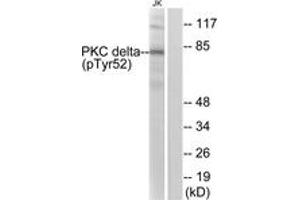 Western blot analysis of extracts from Jurkat cells treated with starved 24h, using PKC delta (Phospho-Tyr52) Antibody. (PKC delta antibody  (pTyr52))