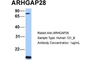 Human 721_B; Host:Rabbit. (ARHGAP28 antibody  (C-Term))