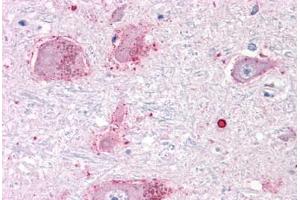 Anti-CHRM3 / M3 antibody  ABIN1048442 IHC staining of human brain, neurons and glia. (CHRM3 antibody  (C-Term))