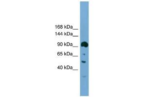 WB Suggested Anti-Ddx20 Antibody Titration:  0. (DDX20 antibody  (N-Term))