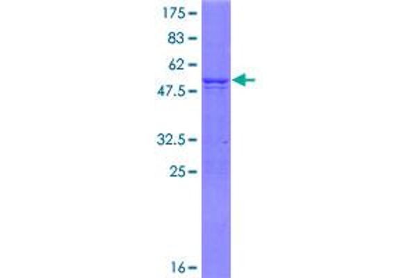 PIP5K1C Protein (AA 1-206) (GST tag)