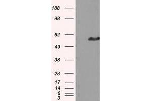 Western Blotting (WB) image for anti-Intraflagellar Transport 57 Homolog (IFT57) antibody (ABIN1498808) (IFT57 antibody)