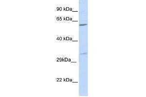 PRPS2 antibody used at 1 ug/ml to detect target protein. (PRPS2 antibody  (N-Term))