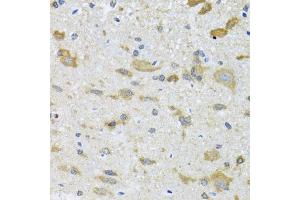 Immunohistochemistry of paraffin-embedded mouse spinal cord using CCT4 antibody (ABIN2561655) at dilution of 1:100 (40x lens). (CCT4 antibody)