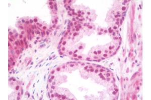 Anti-TRIM33 / TIF1-Gamma antibody IHC staining of human prostate. (TRIM33 antibody  (Internal Region))