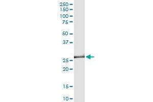 Immunoprecipitation of PROP1 transfected lysate using anti-PROP1 MaxPab rabbit polyclonal antibody and Protein A Magnetic Bead , and immunoblotted with PROP1 purified MaxPab mouse polyclonal antibody (B01P) . (PROP1 antibody  (AA 1-226))