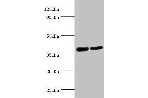 Western blot All lanes: Renin receptor antibody at 2 μg/mL Lane 1: Hela whole cell lysate Lane 2: Mouse heart tissue Secondary Goat polyclonal to rabbit IgG at 1/10000 dilution Predicted band size: 40, 36 kDa Observed band size: 40 kDa (ATP6AP2 antibody  (AA 251-350))