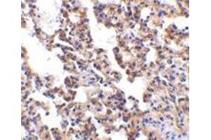 Immunohistochemistry of IL-21 receptor in rat lung with IL-21 receptor antibody at 10 μg/ml.