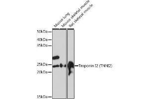 Western blot analysis of extracts of various cell lines, using Troponin I2 (Troponin I2 (TNNI2)) Rabbit mAb (ABIN1679777, ABIN7101727, ABIN7101728 and ABIN7101729) at 1:1000 dilution. (TNNI2 antibody)