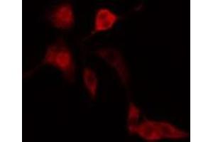 ABIN6277185 staining  Hela cells by IF/ICC.
