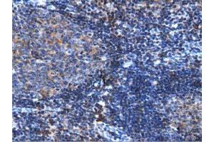 Immunohistochemical staining of paraffin-embedded Human lymph node tissue using anti-ARHGAP25 mouse monoclonal antibody.