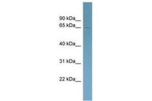 Image no. 1 for anti-Homeobox and Leucine Zipper Encoding (HOMEZ) (AA 431-480) antibody (ABIN6742126) (HOMEZ antibody  (AA 431-480))