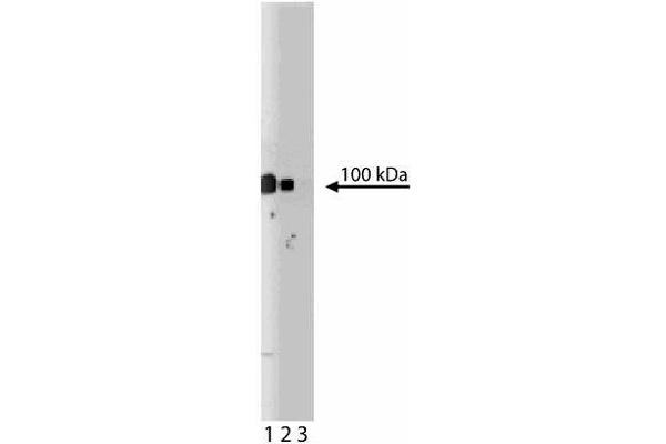 Plakophilin 2 Antikörper  (AA 19-183)