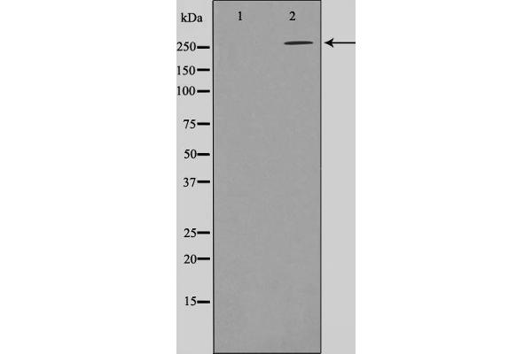 Acetyl-CoA Carboxylase alpha antibody  (pSer79)