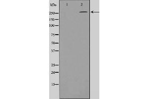 Western blot analysis of ACC1 phosphorylation expression in Insulin treated K562 whole cell lysates,The lane on the left is treated with the antigen-specific peptide. (Acetyl-CoA Carboxylase alpha antibody  (pSer79))