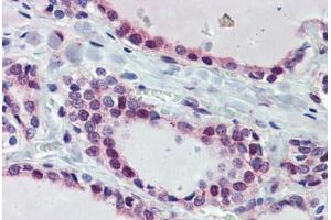 Thyroid, Human: Formalin-Fixed, Paraffin-Embedded (FFPE) (FUBP3 antibody  (AA 503-552))