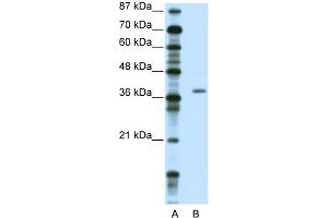 ZNF444 antibody  (C-Term)