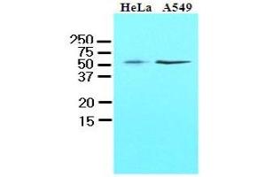 Western Blotting (WB) image for anti-Kruppel-Like Factor 4 (Gut) (KLF4) (AA 1-170), (N-Term) antibody (ABIN336104) (KLF4 antibody  (N-Term))