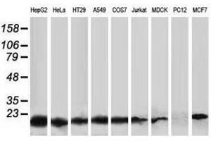 Image no. 3 for anti-Destrin (Actin Depolymerizing Factor) (DSTN) antibody (ABIN1497909) (Destrin antibody)