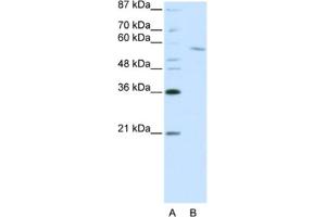 Western Blotting (WB) image for anti-REST Corepressor 1 (RCOR1) antibody (ABIN2461866)