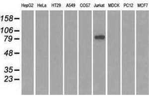 Western blot analysis of extracts (35 µg) from 9 different cell lines by using anti-SATB1 monoclonal antibody. (SATB1 antibody)