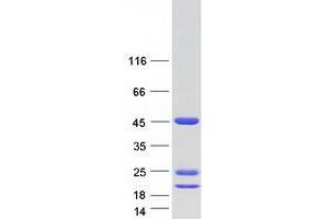 Validation with Western Blot
