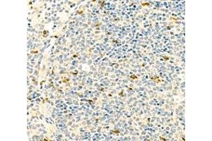 Immunohistochemistry of paraffin embedded rat spleen+LPS using c-caspase3 (ABIN7073336) at dilution of 1:500 (400x lens) (Caspase 3 antibody  (cleaved))