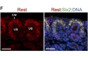 Co-immunostaining for anti-Rest (red) and Six2 (green) showing higher expression levels of Rest in Six2+ cap mesenchyme (CM) surrounding ureteric bud (UB).