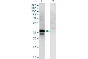 Western Blot analysis of SP2 expression in transfected 293T cell line by SP2 monoclonal antibody (M01), clone 5D3. (Sp2 antibody  (AA 71-161))