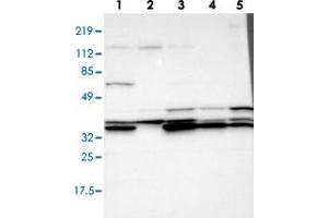 Western blot analysis of Lane 1: RT-4, Lane 2: U-251 MG, Lane 3: A-431, Lane 4: Liver, Lane 5: Tonsil with ADA polyclonal antibody  at 1:100-1:250 dilution.