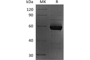 Western Blotting (WB) image for Sialic Acid Binding Ig-Like Lectin 15 (SIGLEC15) (Active) protein (mFc Tag) (ABIN7319766) (SIGLEC15 Protein (mFc Tag))