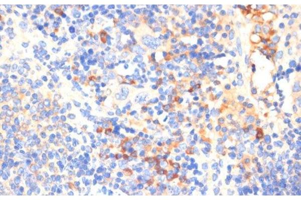 WNK3 antibody
