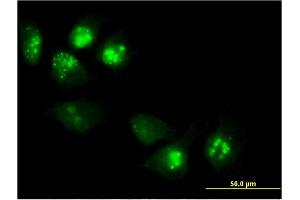 Immunofluorescence of monoclonal antibody to PHLDA1 on HeLa cell. (PHLDA1 antibody  (AA 1-109))