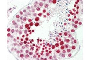 Anti-RBMXL2 antibody IHC staining of human testis. (RBMXL2 antibody  (AA 215-264))