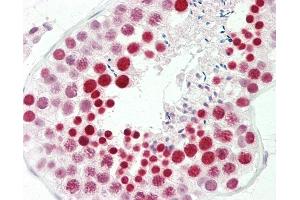Anti-RBMXL2 antibody IHC staining of human testis.