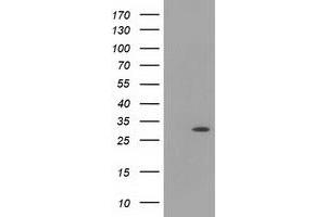 Western Blotting (WB) image for anti-Hydroxyacylglutathione Hydrolase-Like (HAGHL) antibody (ABIN1498572)
