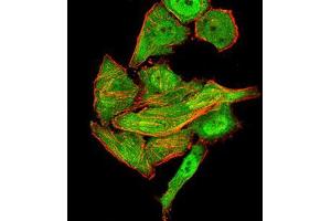 Immunocytochemistry (ICC) image for anti-Synapsin I (SYN1) (AA 362-511) antibody (ABIN5542390)