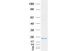Western Blotting (WB) image for Ubiquitin-Conjugating Enzyme E2L 6 (UBE2L6) (Transcript Variant 1) protein (Myc-DYKDDDDK Tag) (ABIN2734858)