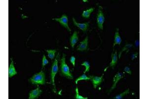 Immunofluorescent analysis of Hela cells using ABIN7158683 at dilution of 1:100 and Alexa Fluor 488-congugated AffiniPure Goat Anti-Rabbit IgG(H+L) (KARS antibody  (AA 101-400))