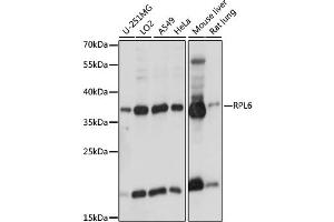 Western blot analysis of extracts of various cell lines, using RPL6 antibody (ABIN6291596) at 1:1000 dilution.