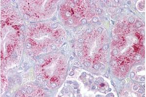 Immunohistochemistry with Kidney tissue at an antibody concentration of 5µg/ml using anti-P2RX2 antibody (ARP35436_P050) (P2RX2 antibody  (N-Term))