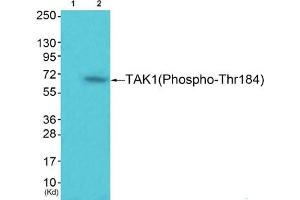 Western blot analysis of extracts from 293 cells (Lane 2), using TAK1 (Phospho-Thr184) Antibody. (MAP3K7 antibody  (pThr184))