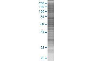NTNG1 transfected lysate. (NTNG1 293T Cell Transient Overexpression Lysate(Denatured))