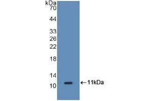 Detection of Recombinant S100A8, Mouse using Polyclonal Antibody to S100 Calcium Binding Protein A8 (S100A8) (S100A8 antibody  (AA 1-89))